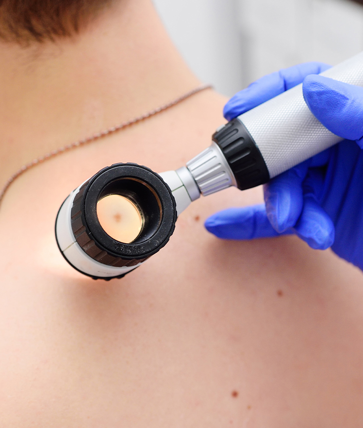 Photo of a dermatologist using a dermatoscope on a patient